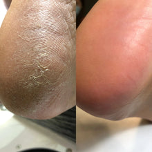 Load image into Gallery viewer, NAILSOFTHEDAY Keratolytic — Queratolítico para pies con Urea 20%, 100 ml