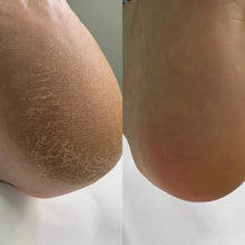 Load image into Gallery viewer, NAILSOFTHEDAY Keratolytic — Queratolítico para pies con Urea 20%, 100 ml
